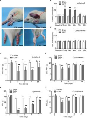 TRPV1 Channel Contributes to the Behavioral Hypersensitivity in a Rat Model of Complex Regional Pain Syndrome Type 1